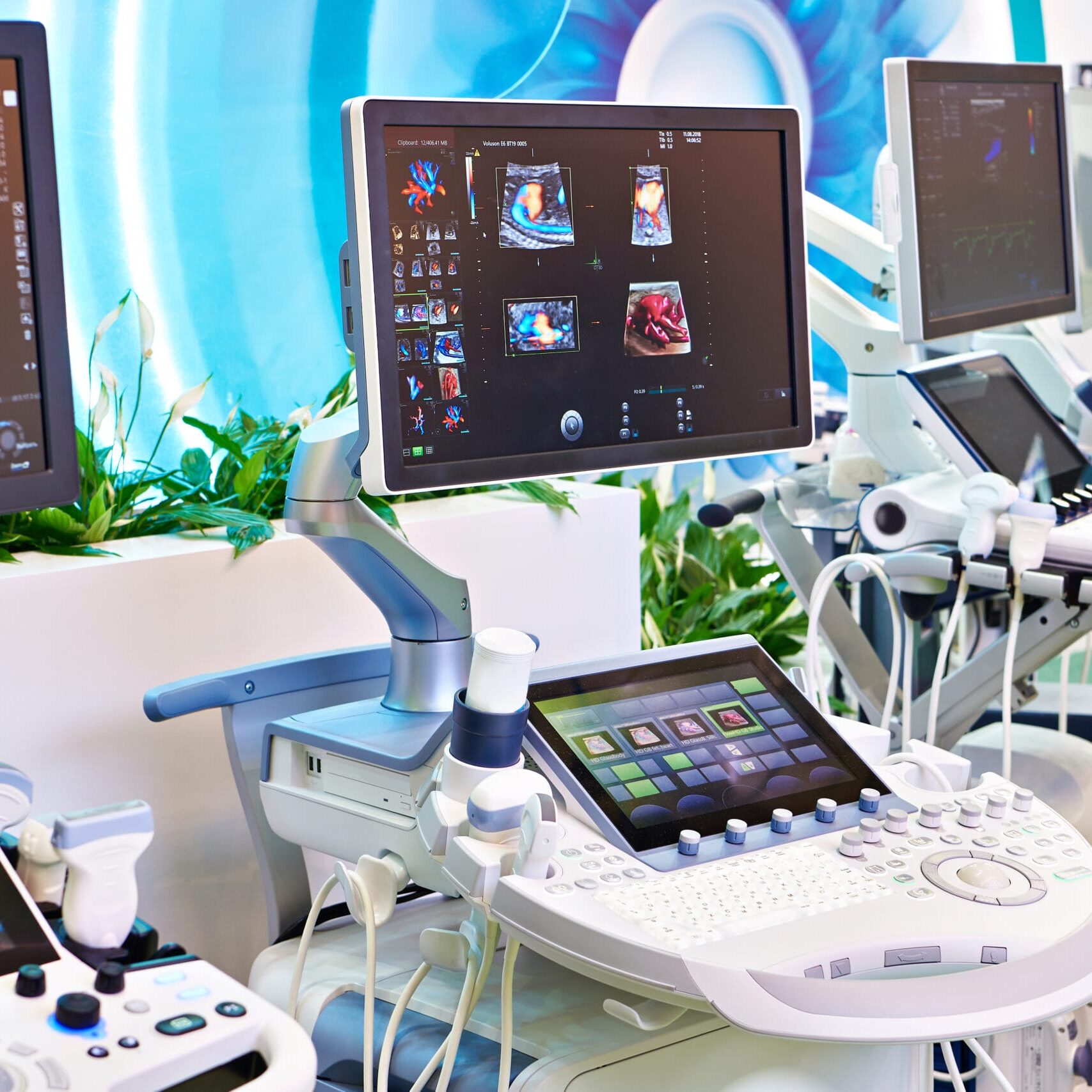 Medical devices for ultrasound examination on exhibition